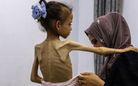 الصحة العالمية: الجوع سيقتل 132 ألف طفل في غزة دون سن الخامسة